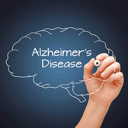 Alzheimer's disease in brain